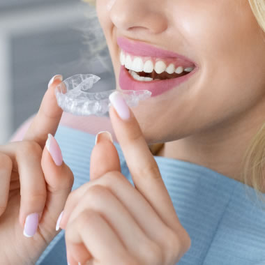 Invisalign