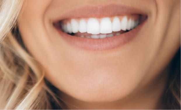 Teeth Whitening
